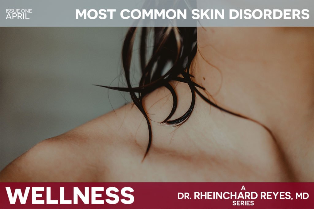 skin disorders